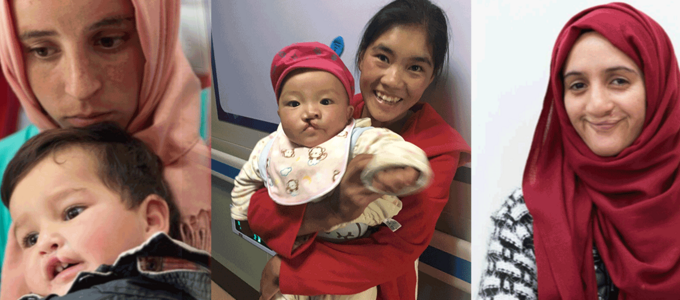 Image - Alliance for Smiles